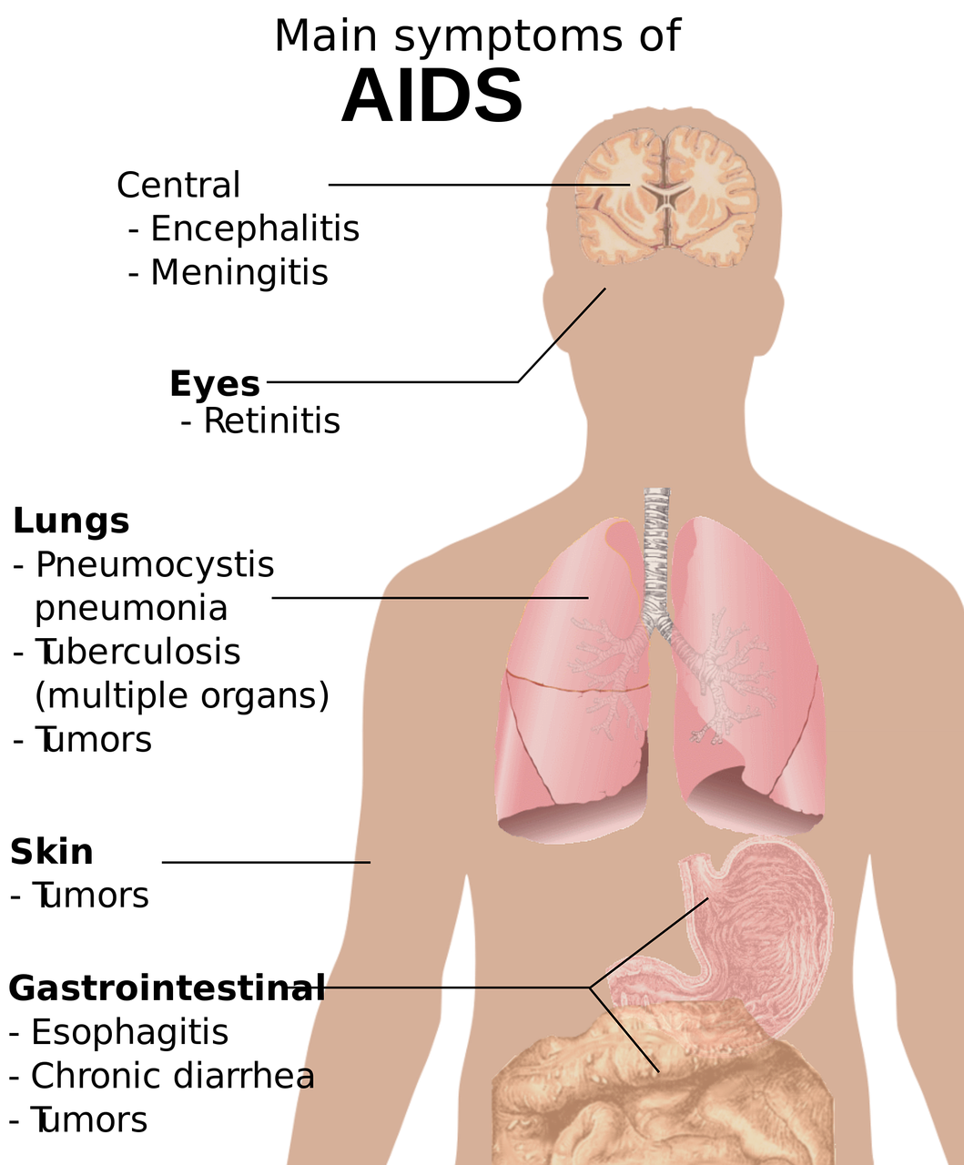 Health Lesson Plans: All About HIV and AIDS