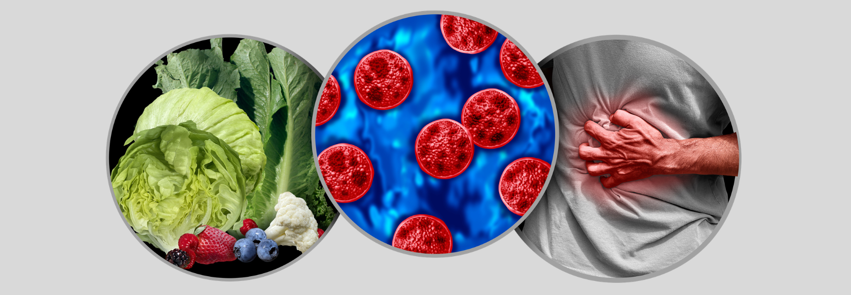 The Cyclospora Outbreak: What a Salad-Borne Parasite Reveals About America’s Food Safety Net